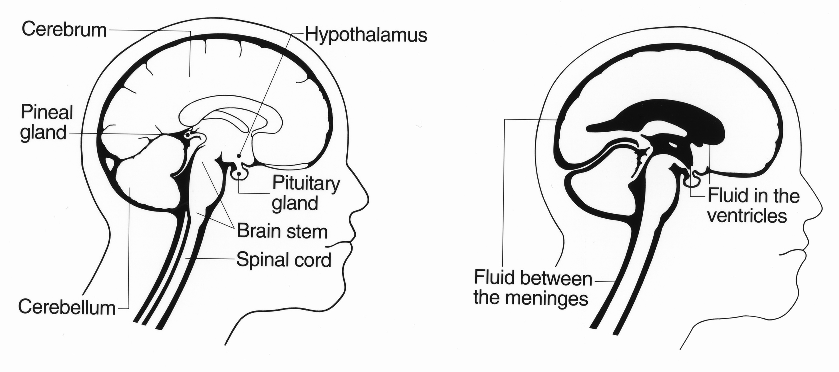 Diagrama del cerebro humano que señala la ubicación del hipotálamo y la hipófisis