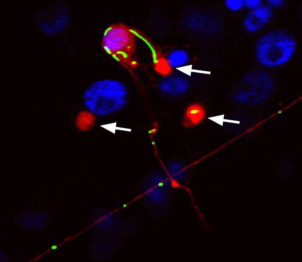 human neurons microscope