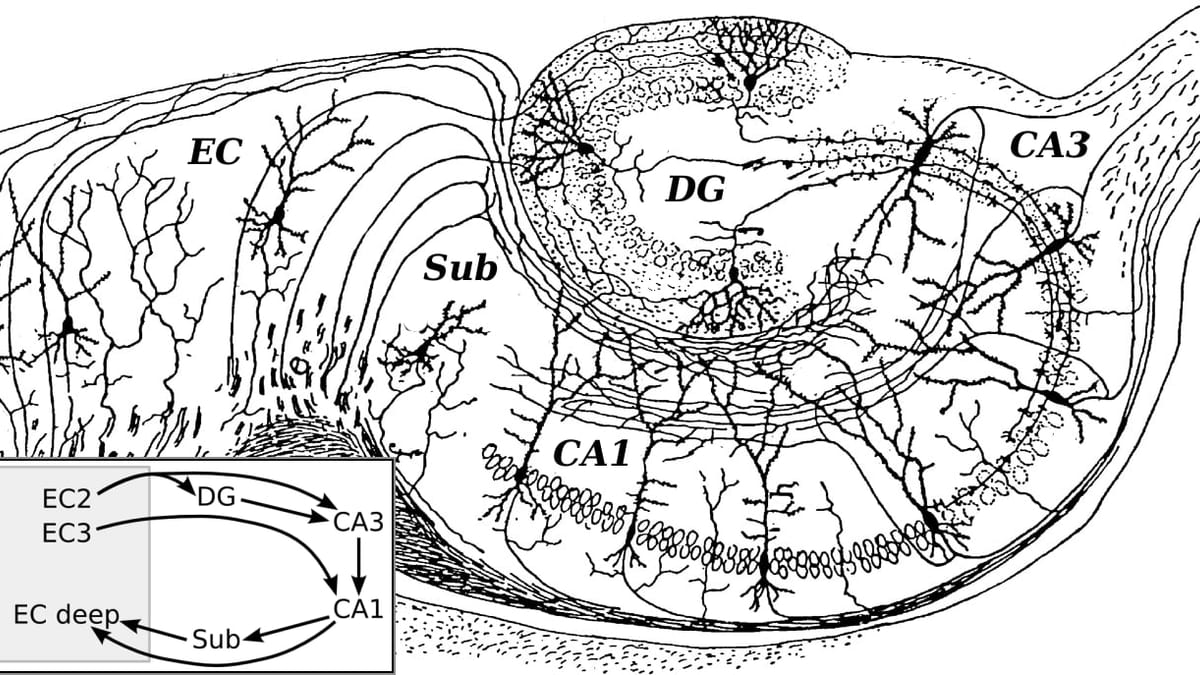 Representación anatómica del cerebro humano