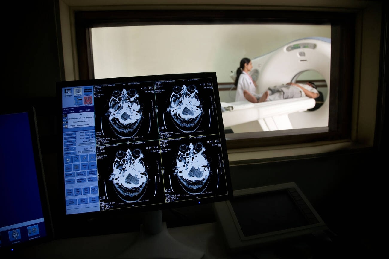 Imagen cerebral utilizada en el diagnóstico de un ACV